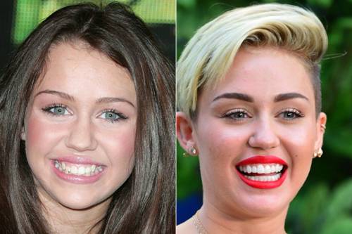 Famous Hollywood Celebrities Masquerading With Fake Teeth