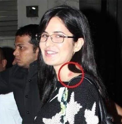 13 Bollywood Celebrities Who Were Snapped With Hickeys &amp; Love Bites