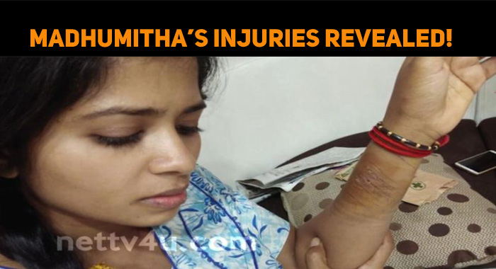 Jangiri Madhumitha’s Injuries Revealed!