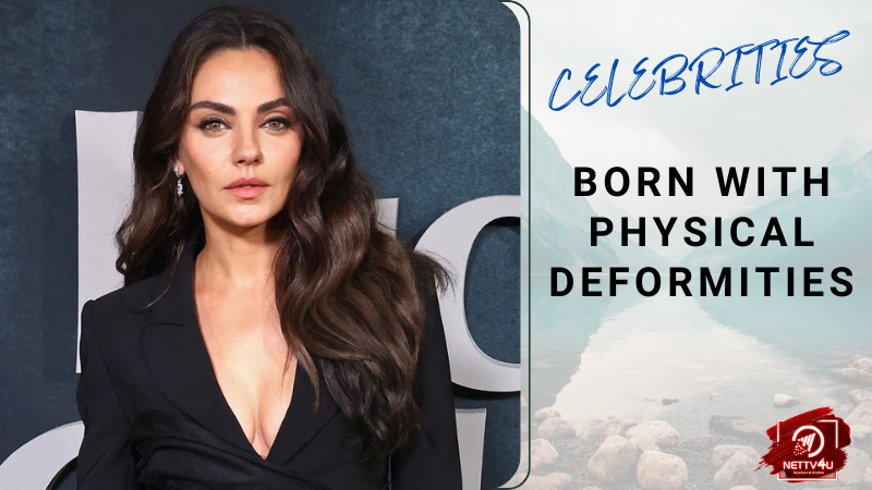 Celebrities Born With Physical Deformities English Article