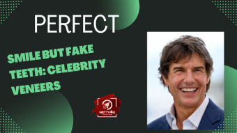 Perfect Smile But Fake Teeth: Celebrity Veneers