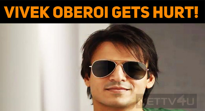 Vivek Oberoi Gets Hurt!